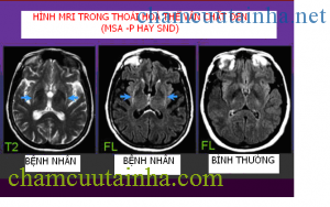 Teo đa hệ thống 4