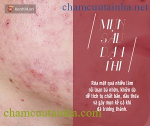 Những dấu hiệu cho thấy bạn đang làm hỏng da vì rửa mặt quá nhiều - Ảnh 4.