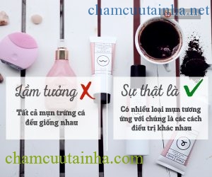 Bỏ ngay 6 lầm tưởng này nếu muốn trị mụn dứt điểm, hiệu quả - Ảnh 2.