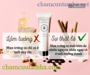 Bỏ ngay 6 lầm tưởng này nếu muốn trị mụn dứt điểm, hiệu quả - Ảnh 5.