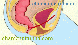 Việc đi vệ sinh đơn giản nhưng hầu hết chúng ta đều đang làm sai - Ảnh 1.