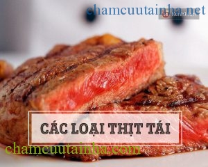 Top các thực phẩm nguy hiểm dẫn sán vào người - Ảnh 3.