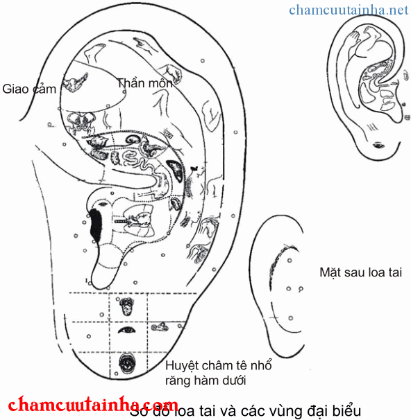 nhĩ châm và các vùng trên loa tai