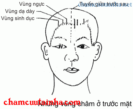 phương pháp đầu châm