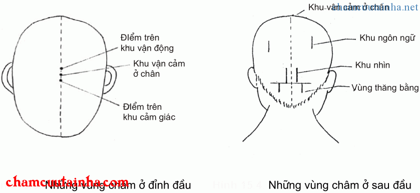 dùng đầu châm chữa bệnh