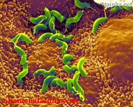 Điều trị nhiễm Helicobacter pylori 1